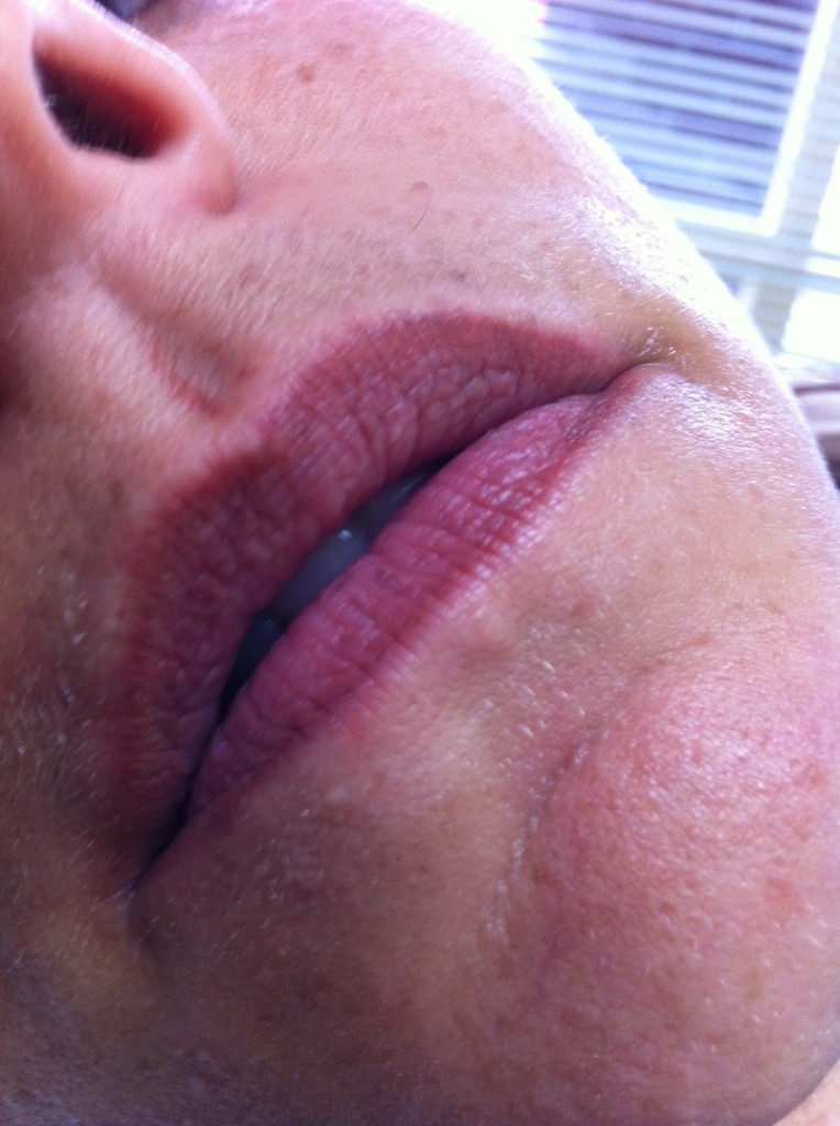 !cid_IMG_54551